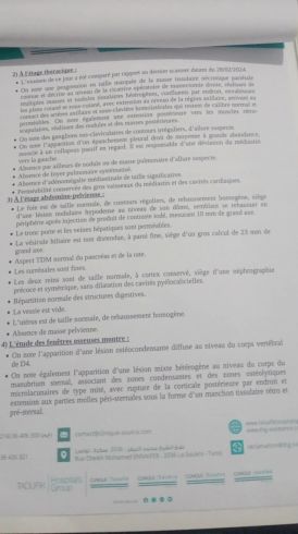 Traitement anticancéreux pour une maman tunisienne