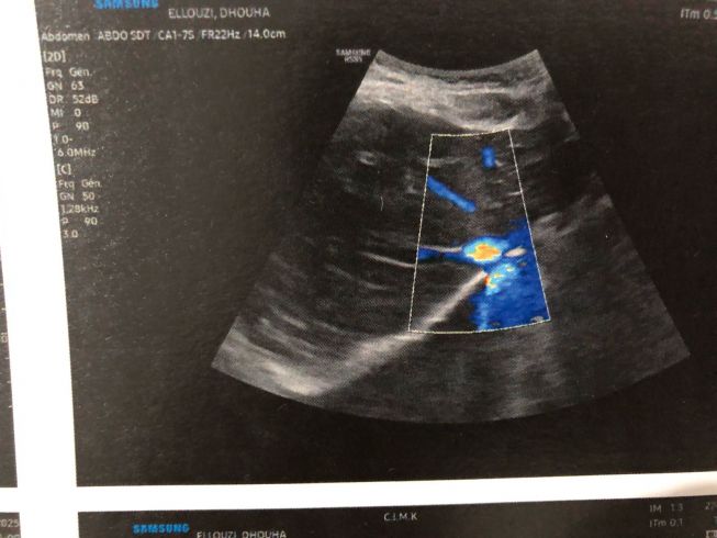 مساعدة للعلاج مساعدة للعلاج